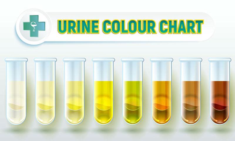Color of urine