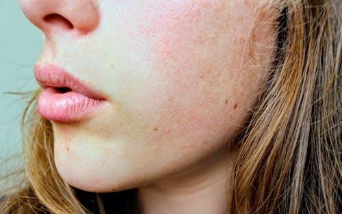 Do not apply waxing on your soft face even by mistake, read Its side effects