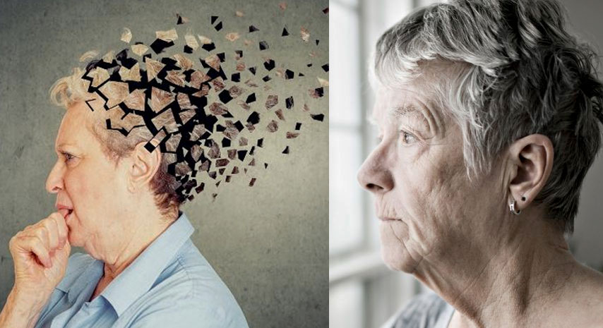 Alzheimer's disease