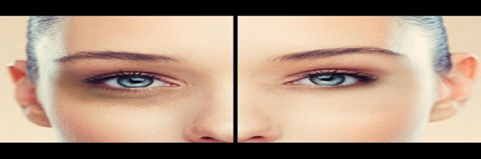 ice cubes benefits on dark circles