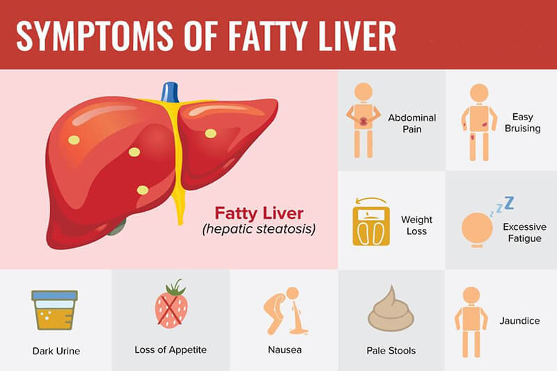 complications of fatty liver