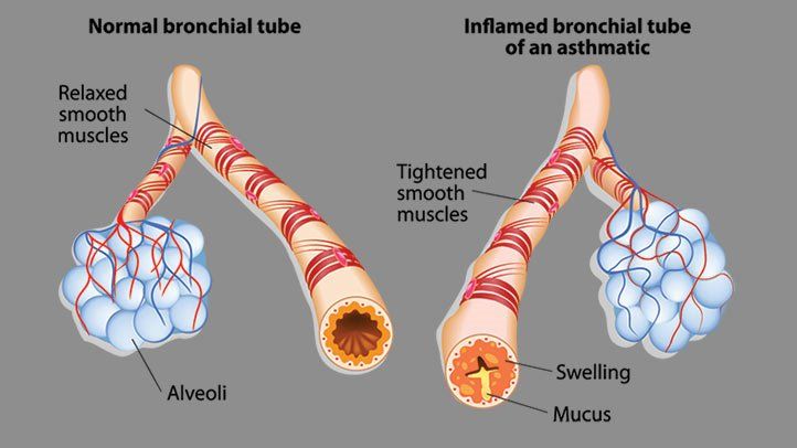 best treatments for asthma