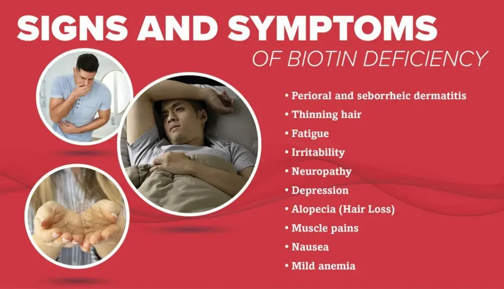 Biotin deficiency can lead to such consequences 6 Symptoms of Biotin Deficiency