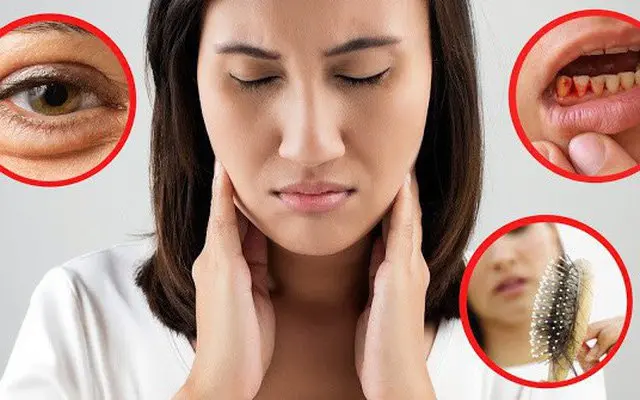 Biotin deficiency can lead to such consequences 5 biotin deficiency