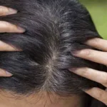 White Hair: Lack of this vitamin causes hair to turn white quickly