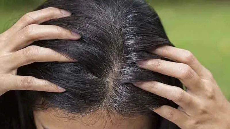 White Hair: Lack of this vitamin causes hair to turn white quickly