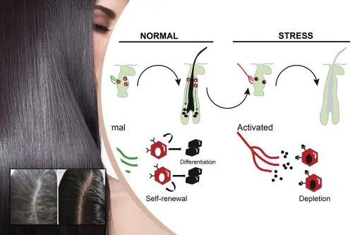 White Hair: Lack of this vitamin causes hair to turn white quickly 6 White Hair due to stress