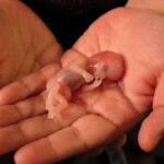 Repeated Miscarriage