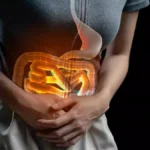 Stomach Heat Remedies